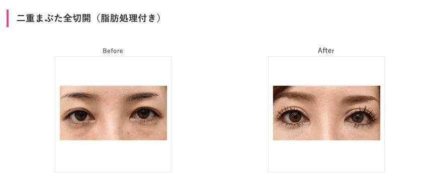 渋谷美容外科の症例写真